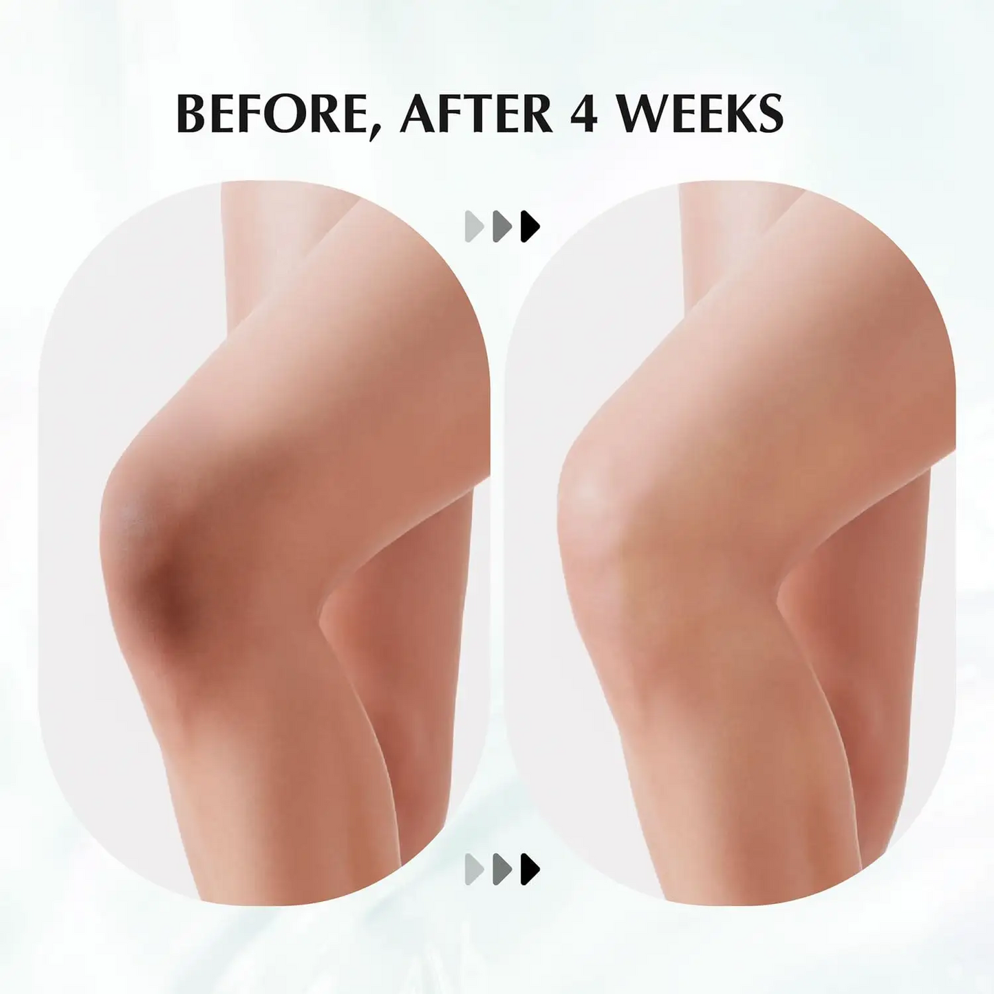 Dark Spot Corrector Cream For Body, Premium Dark Spot Remover Cream For Face, Armpits, Underarm, Knees, Thighs and Elbows 694