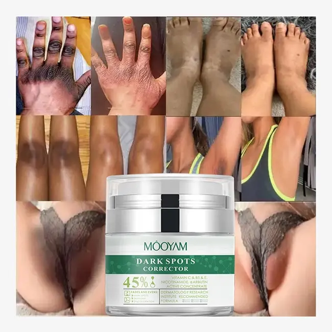 Wholesale Strong Removal 7 Days Dark Spot Corrector Skin Care Private Label Whitening Freckle Face Cream 700
