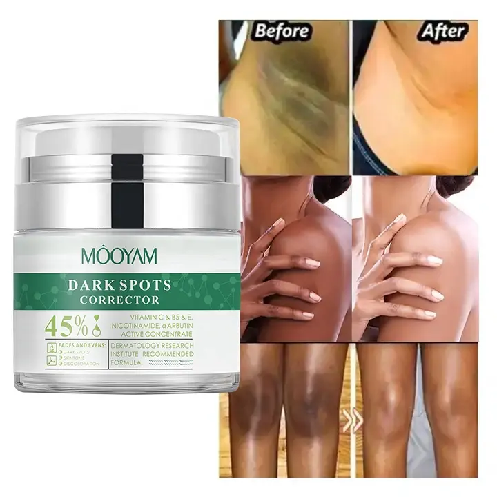 Wholesale Strong Removal 7 Days Dark Spot Corrector Skin Care Private Label Whitening Freckle Face Cream 700