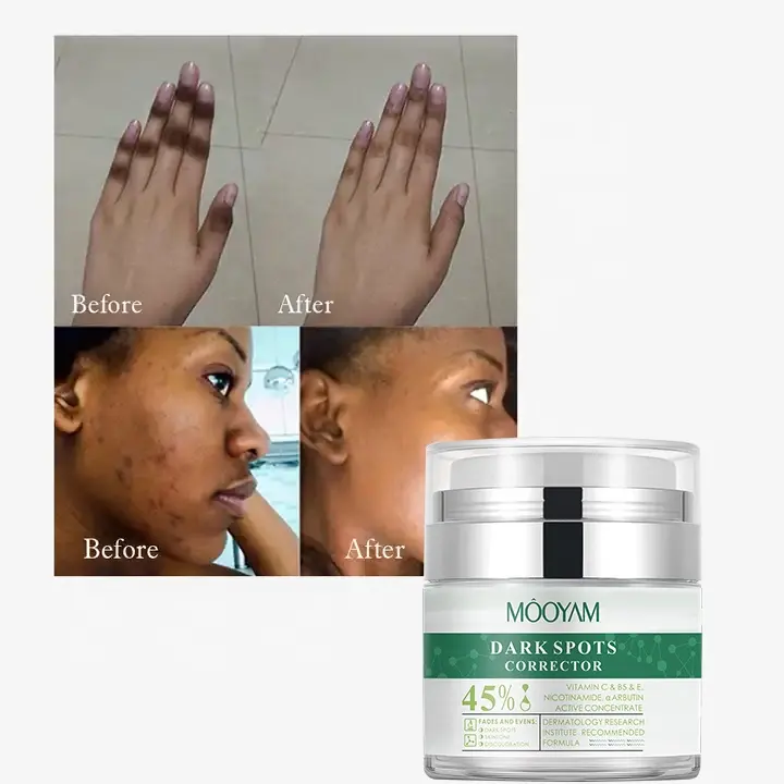 Wholesale Strong Removal 7 Days Dark Spot Corrector Skin Care Private Label Whitening Freckle Face Cream 700