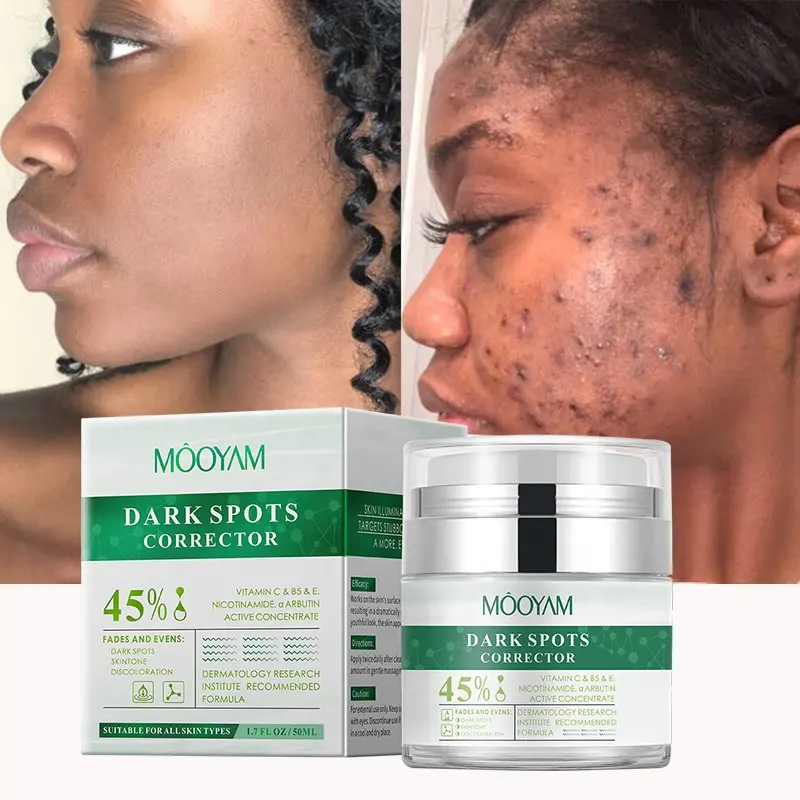 Wholesale Strong Removal 7 Days Dark Spot Corrector Skin Care Private Label Whitening Freckle Face Cream 700