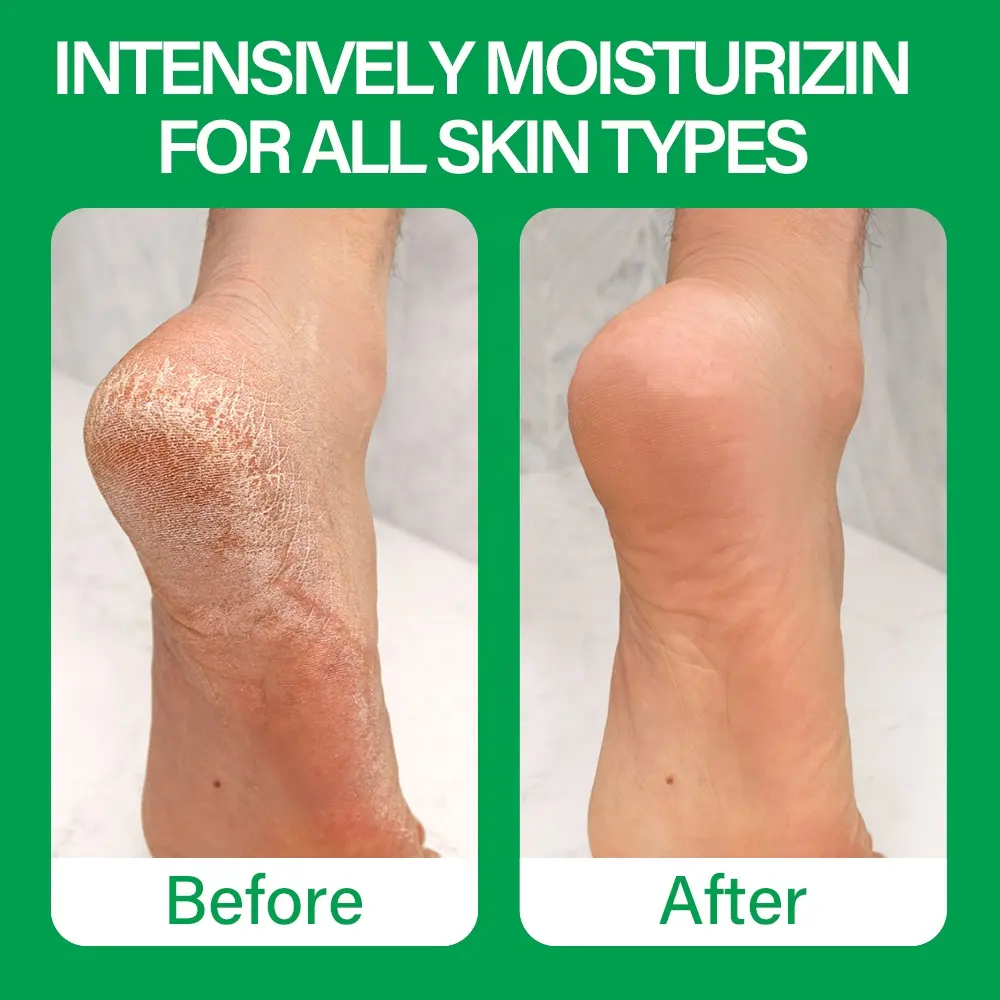 Private Label Foot Repair Care Cream Softens Conditions Dry Cracked Feet Heels Tea Tree Oil Foot Cream 716