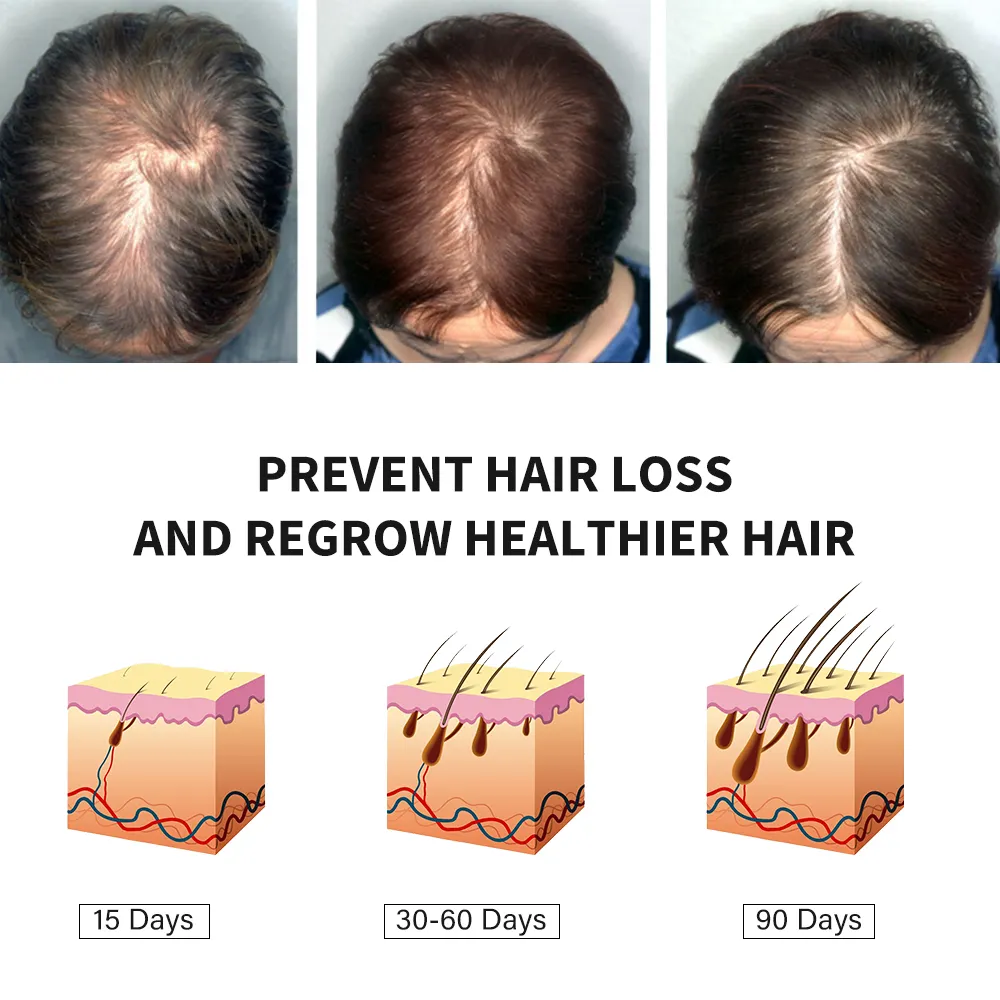 Rosemary Mint Scalp &Hair Strengthening Oil 100% Pure Nature Organic Fast Effective Hair Growth Oil 728