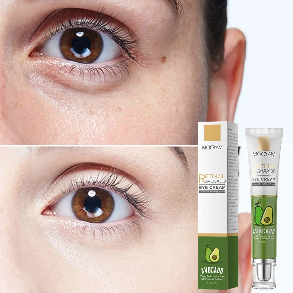 Private Label Organic Natural Anti-Aging Eye Cream Anti-Wrinkle Retinol Eye Cream With Avocado 768