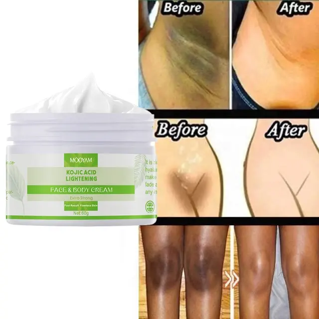 Kojic Acid Face Cream Anti Aging Wrinkle Beauty Dark Spot Removing Acne Skin Whitening Lightening Face Cream 792