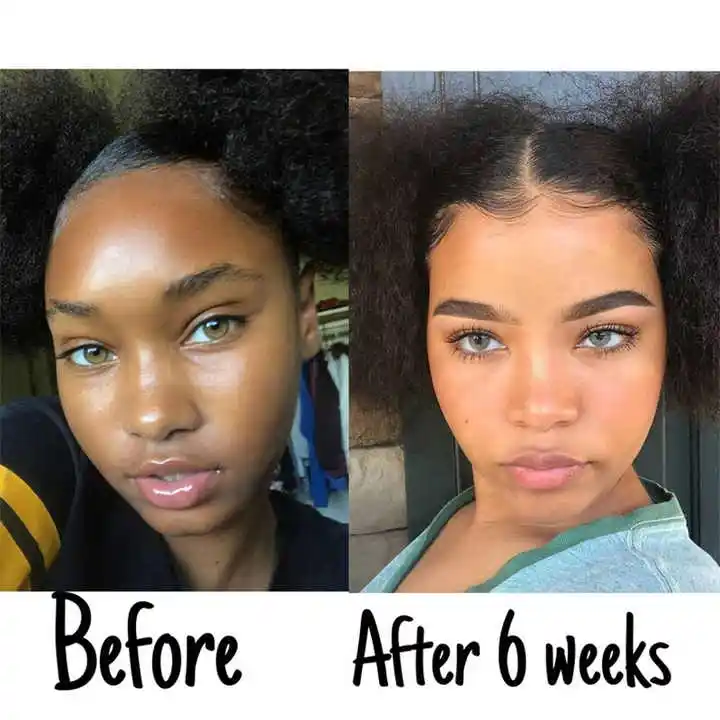 Private Label Hot Sale Facial Strong Lightening Turmeric Toner For Dark Spots Eraser Even Skin Tone Flawless Skin 908