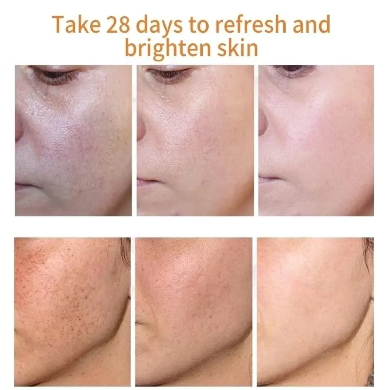 7 Days Dark Spots Anti Freckle Whitening Cream Strong Powerful Dark Spot Removal Cream 914