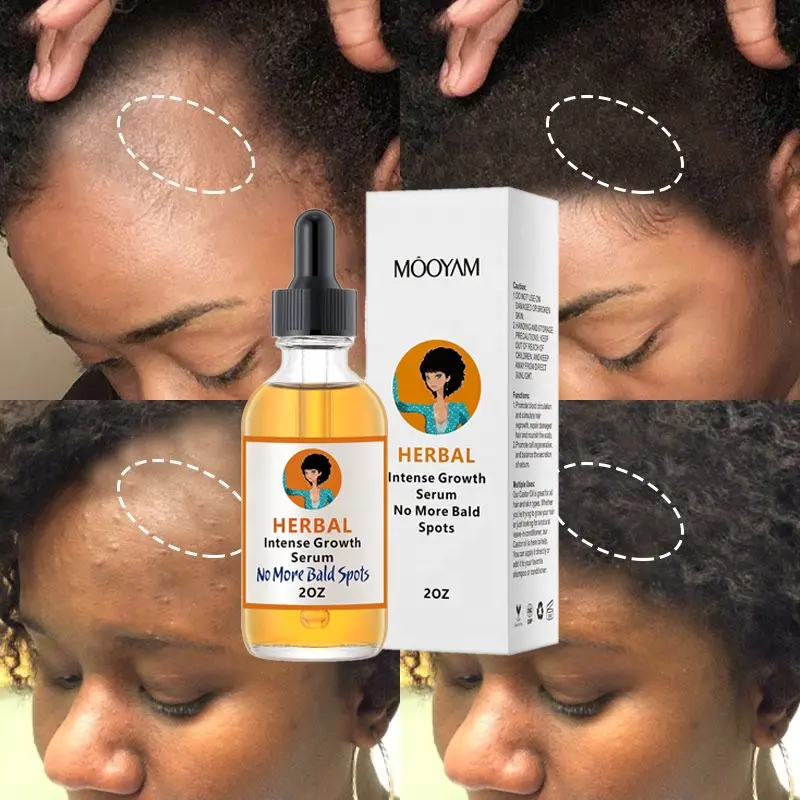 Hot Sell Private Label 100% Natural Formula Wholesale Nourishing Scalp Elixirs Hair Care Loss Treatment Hair Growth Oil Serum 944