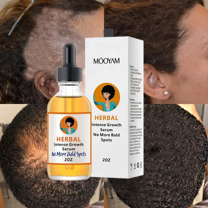 Hot Sell Private Label 100% Natural Formula Wholesale Nourishing Scalp Elixirs Hair Care Loss Treatment Hair Growth Oil Serum 944