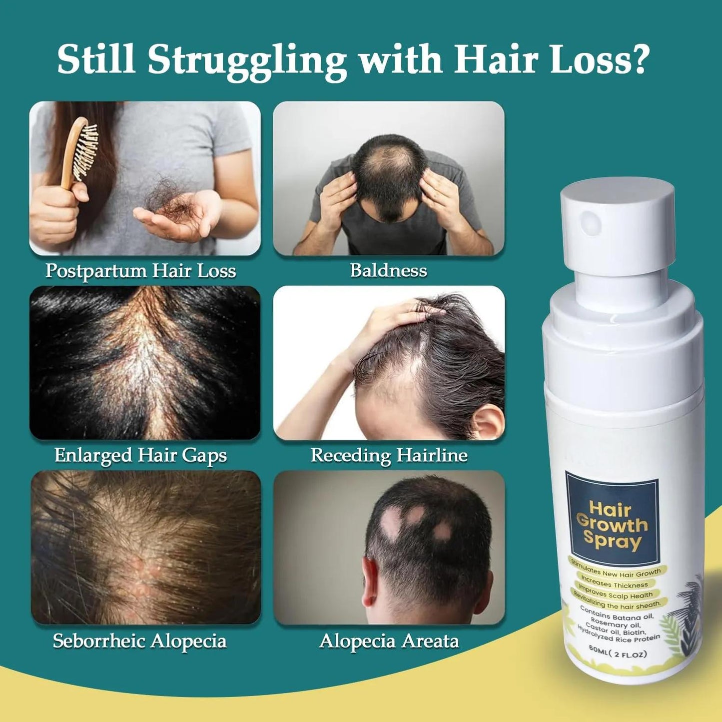 Private Label Hair Regrowth Thickening Hair Spray Natural Hair Growth Oil Spray with Batana Rosemary Biotin Caffeine 959