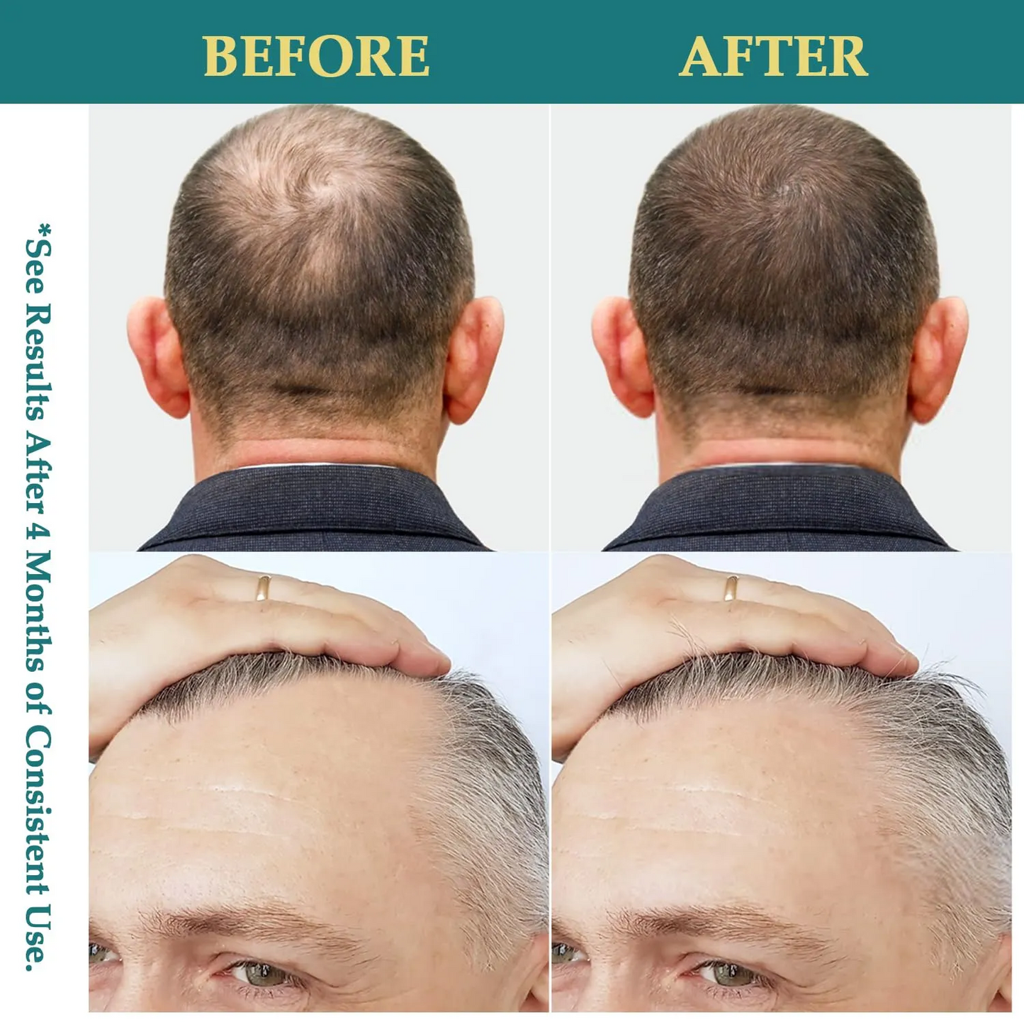 Private Label Hair Regrowth Thickening Hair Spray Natural Hair Growth Oil Spray with Batana Rosemary Biotin Caffeine 959