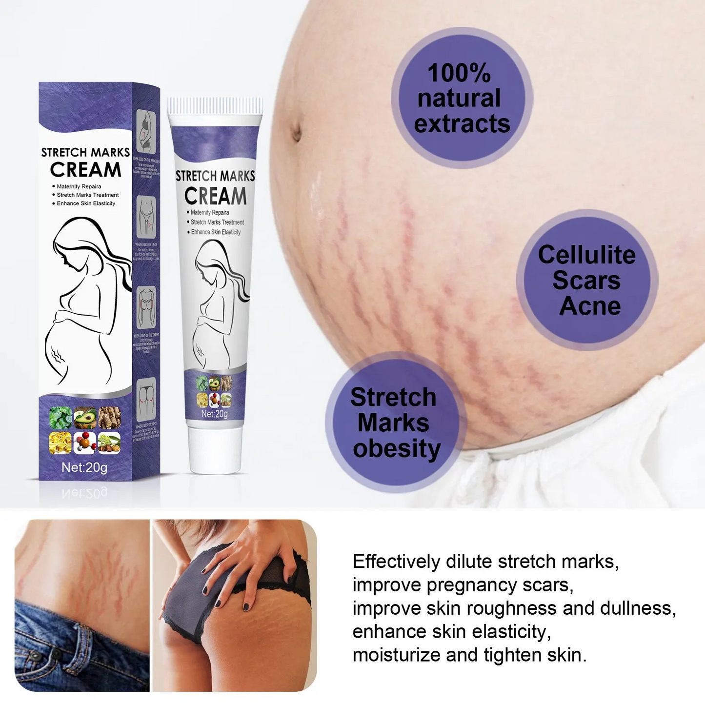 Wholesale Postpartum Stretch Mark Cream OEM Abdomen Thighs Leg Buttocks Chest Pregnancy Stretch Mark Removal Cream For Female 1002