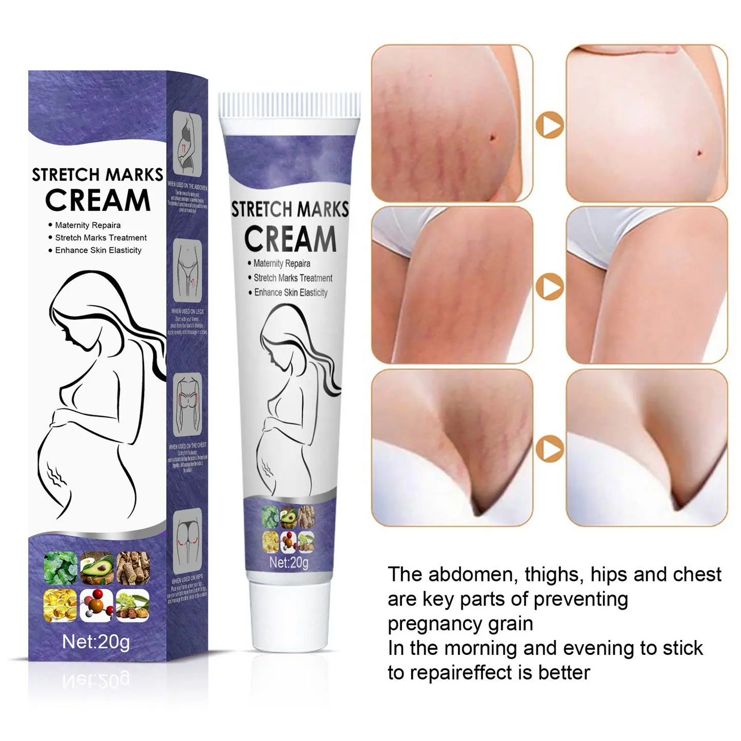 Wholesale Postpartum Stretch Mark Cream OEM Abdomen Thighs Leg Buttocks Chest Pregnancy Stretch Mark Removal Cream For Female 1002
