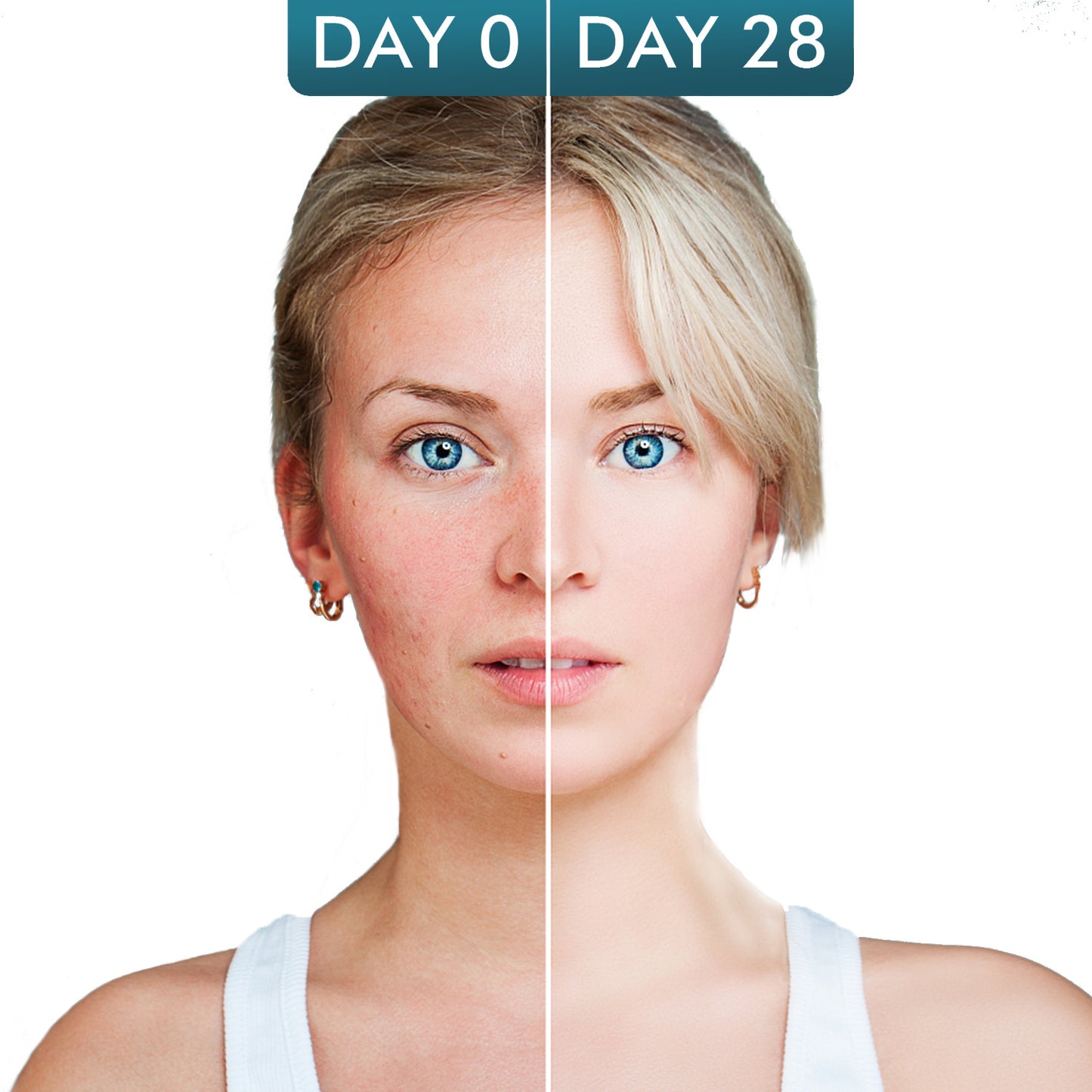 OEM Customized Wholesale Retinol Hyaluronic Acid Facial Moisturizer, Vitamin A Essence Cream 302