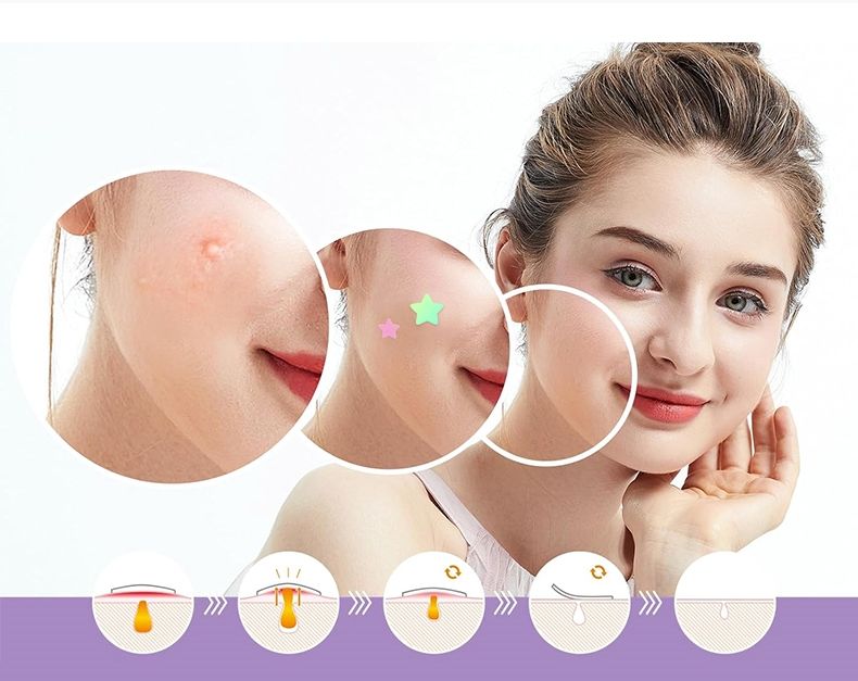 Colourful Fashion Designs Cute Half Moon Star Cloud Butterfly Flower Shape Shiny Laser Pimple Acne Patch