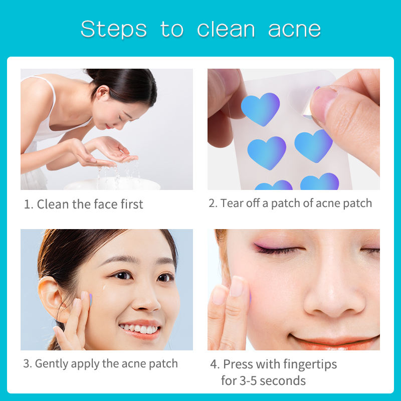 Cross-Border Special Supply of Color Laser Acne Patch for Makeup Fashion Love and Water Drop Shape Pimple Patch