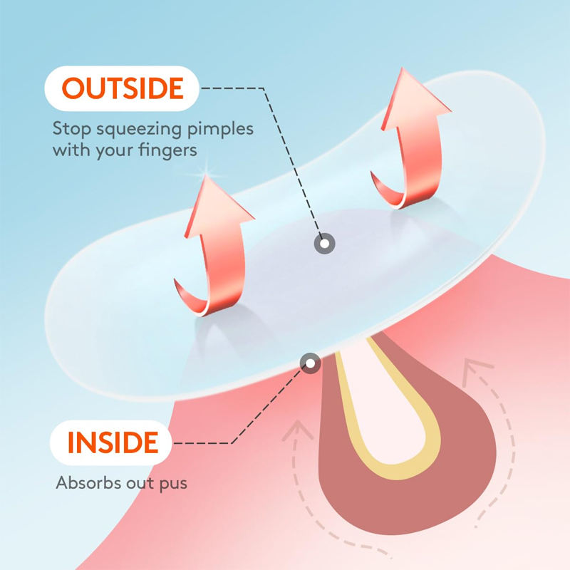 Custom 15g Hydrocolloid Spot Patch for Acne Pimple Healing Private Label Household Use Beauty & Personal Care Product