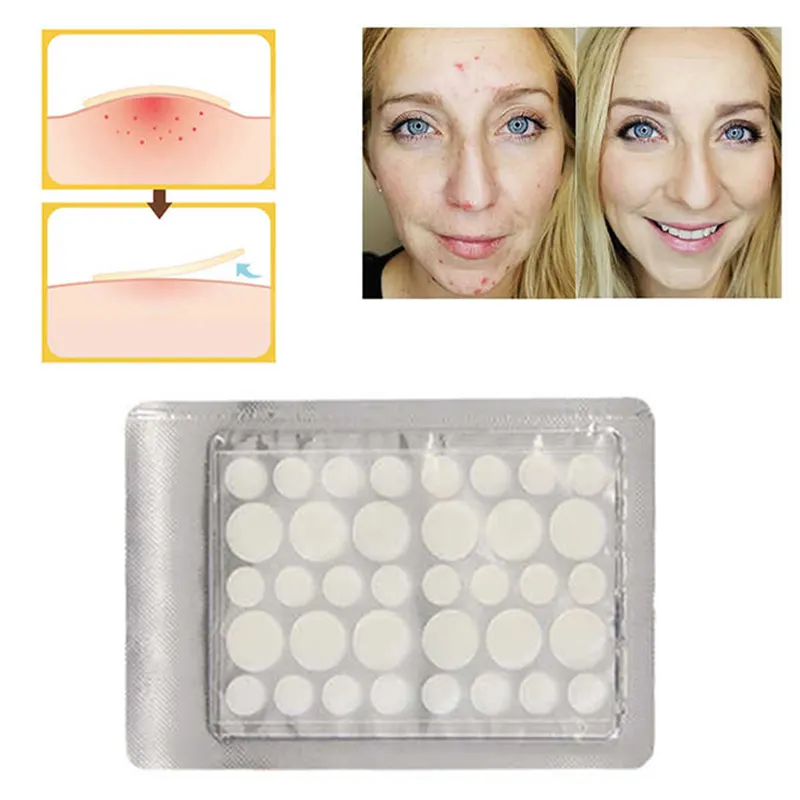 Hydrocolloid Pimple Patch, Salicylic Acid Acne Patch, Invisible Acne Mark Acne Patch Factory 088