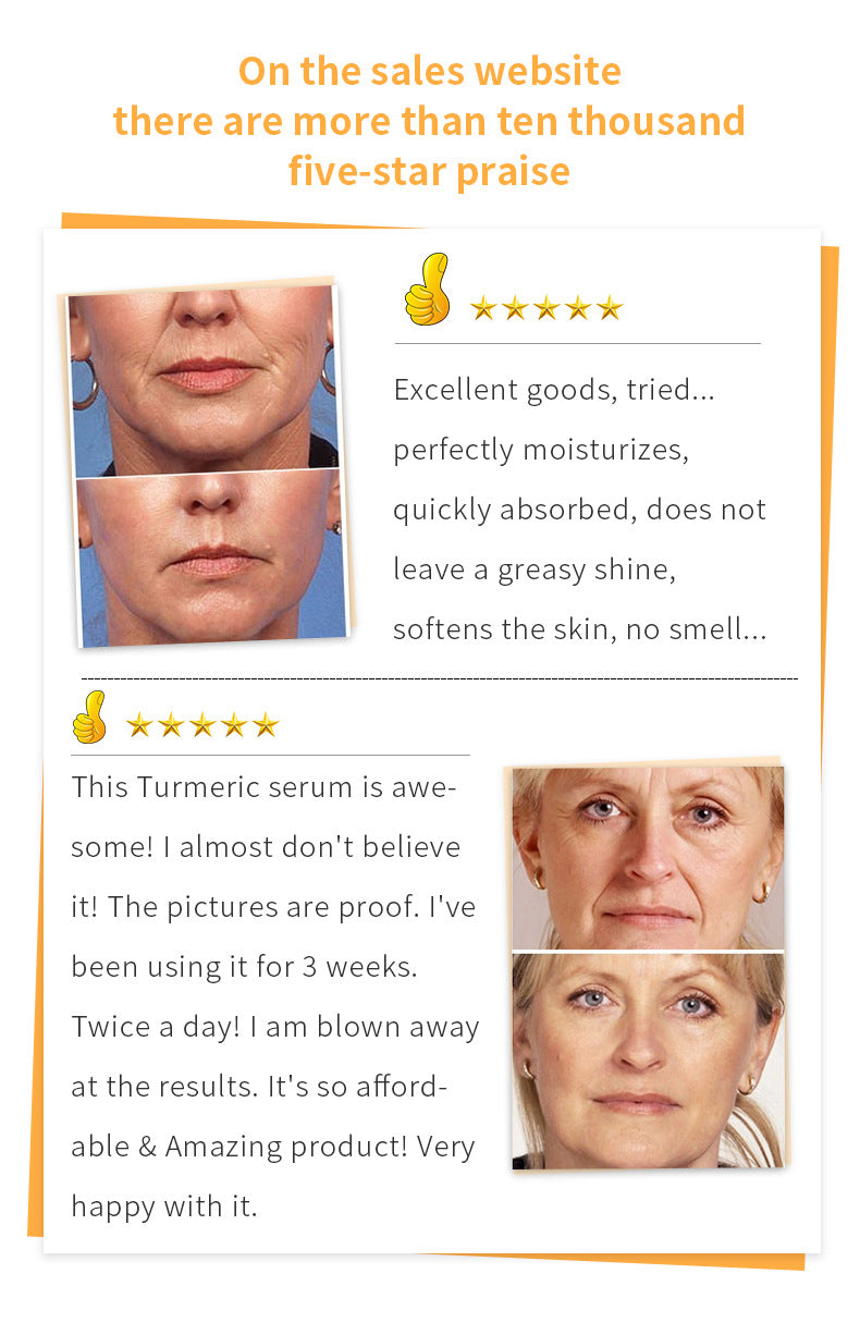 OEM Private Label 30ML Turmeric Serum, Moisturizes, Fades Acne Marks, Fine Lines, Anti-aging Facial Essence 354