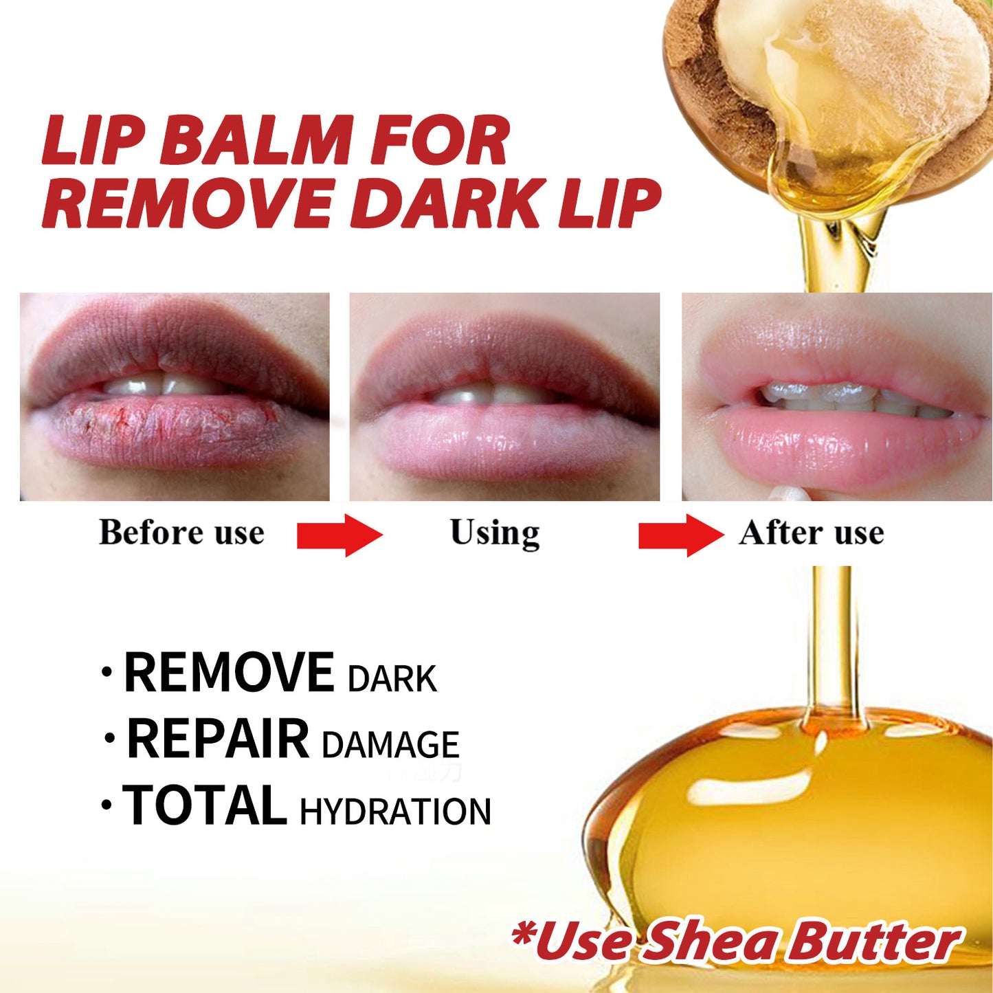 OEM Customized Lip Balm, Black Lip Removal, Lip Wrinkle Removal, Lip Care 381