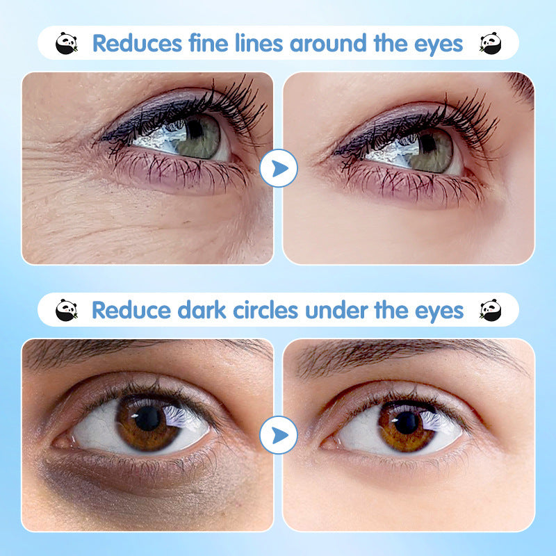 Wholesale Blue Berry Hydrating Nourish Eye Area, Improve Dark Eye Circles Eye Mask OEM Manufacturer 547