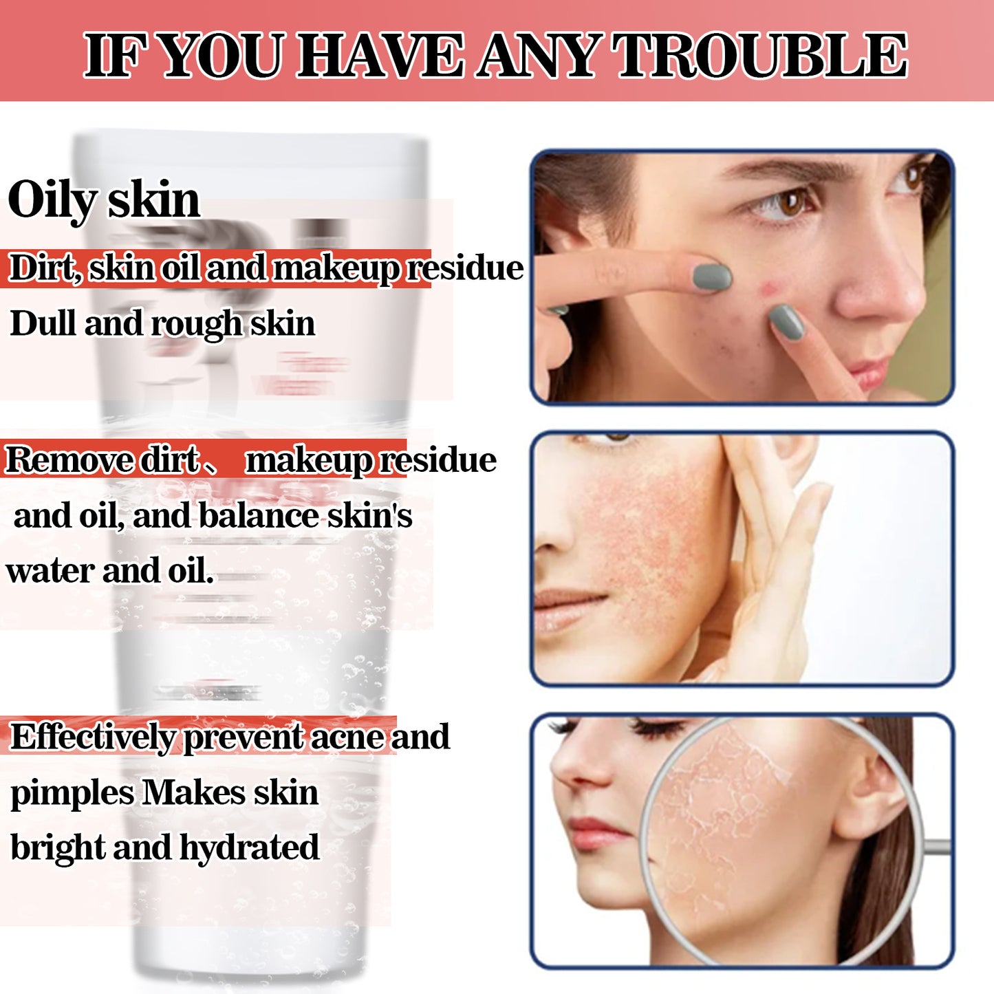 OEM Wholesale Kojic Acid Facial Cleanser, Acne Cleansing Treatment, Pore Shrinking Facial Cleansing 379