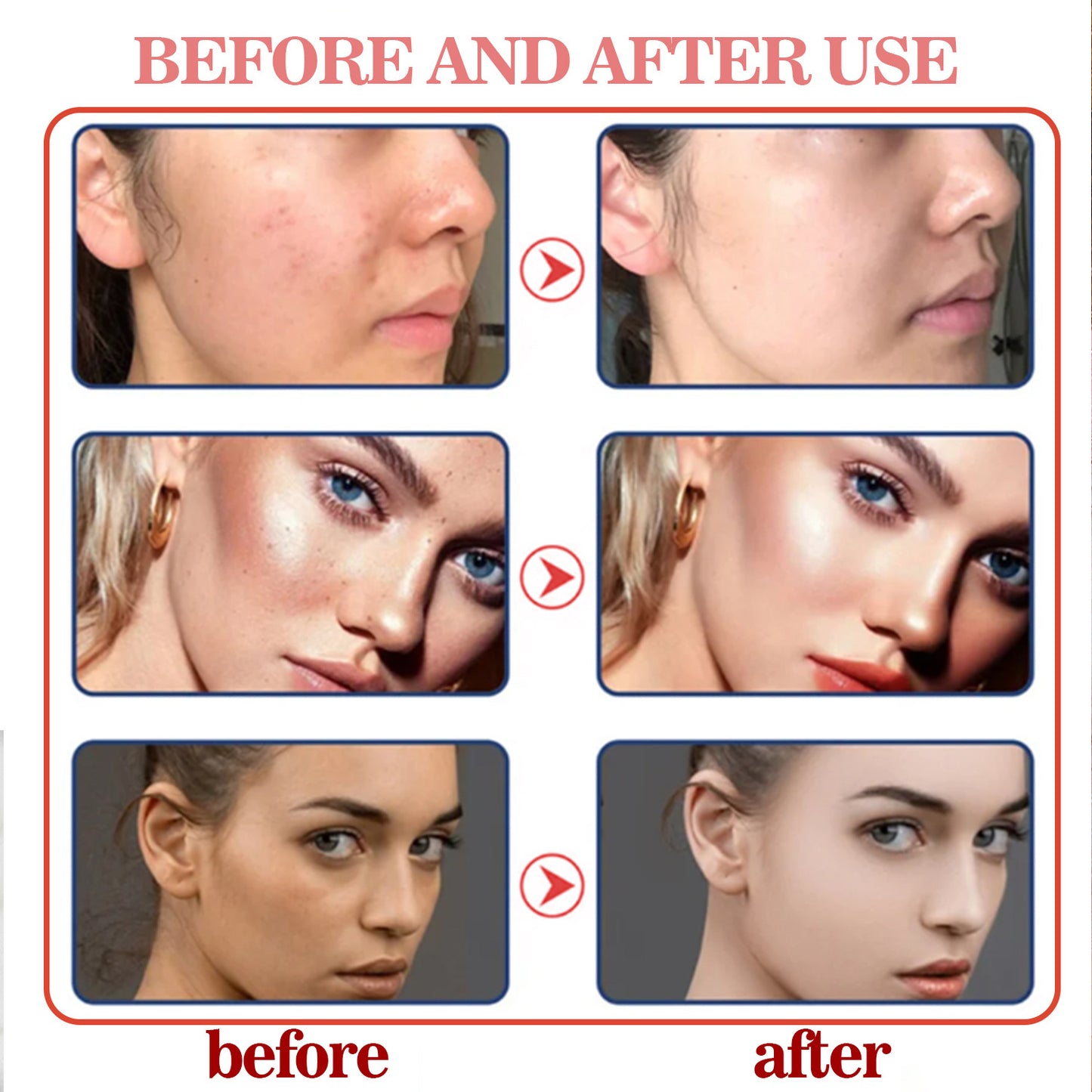 OEM Wholesale Kojic Acid Facial Cleanser, Acne Cleansing Treatment, Pore Shrinking Facial Cleansing 379