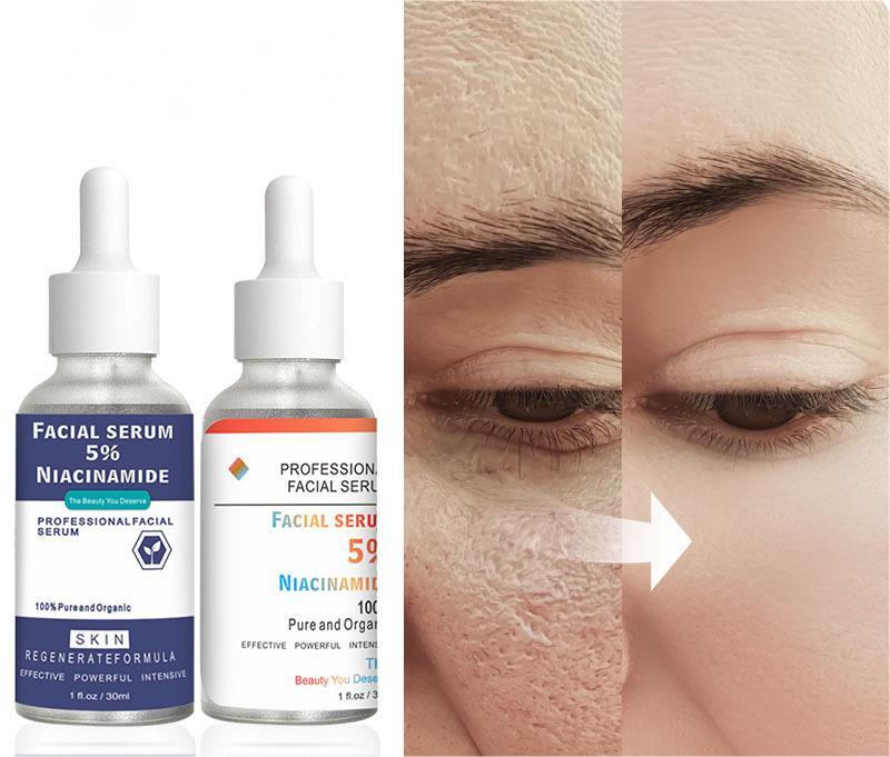 OEM /ODM Popular Essence Moisturizing Niacinamide Serum Tightening Pores Essence 009
