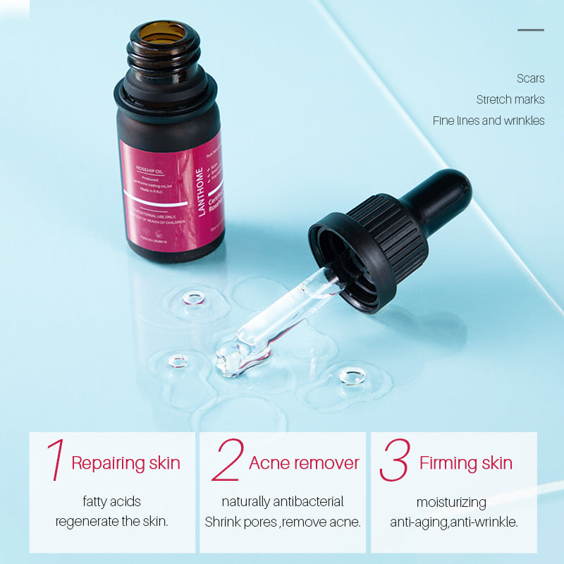 OEM Customized Rosehip Oil, Hydrating, Moisturizing, Anti-Wrinkle and Firming Skin 375