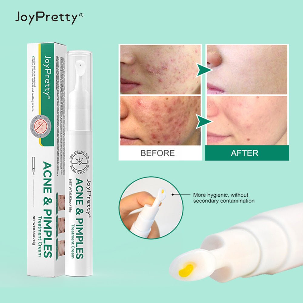 OEM Wholesale Acne Removal Cream, Fade Acne Marks, Acne Removal, Scar Removal Face Cream 270