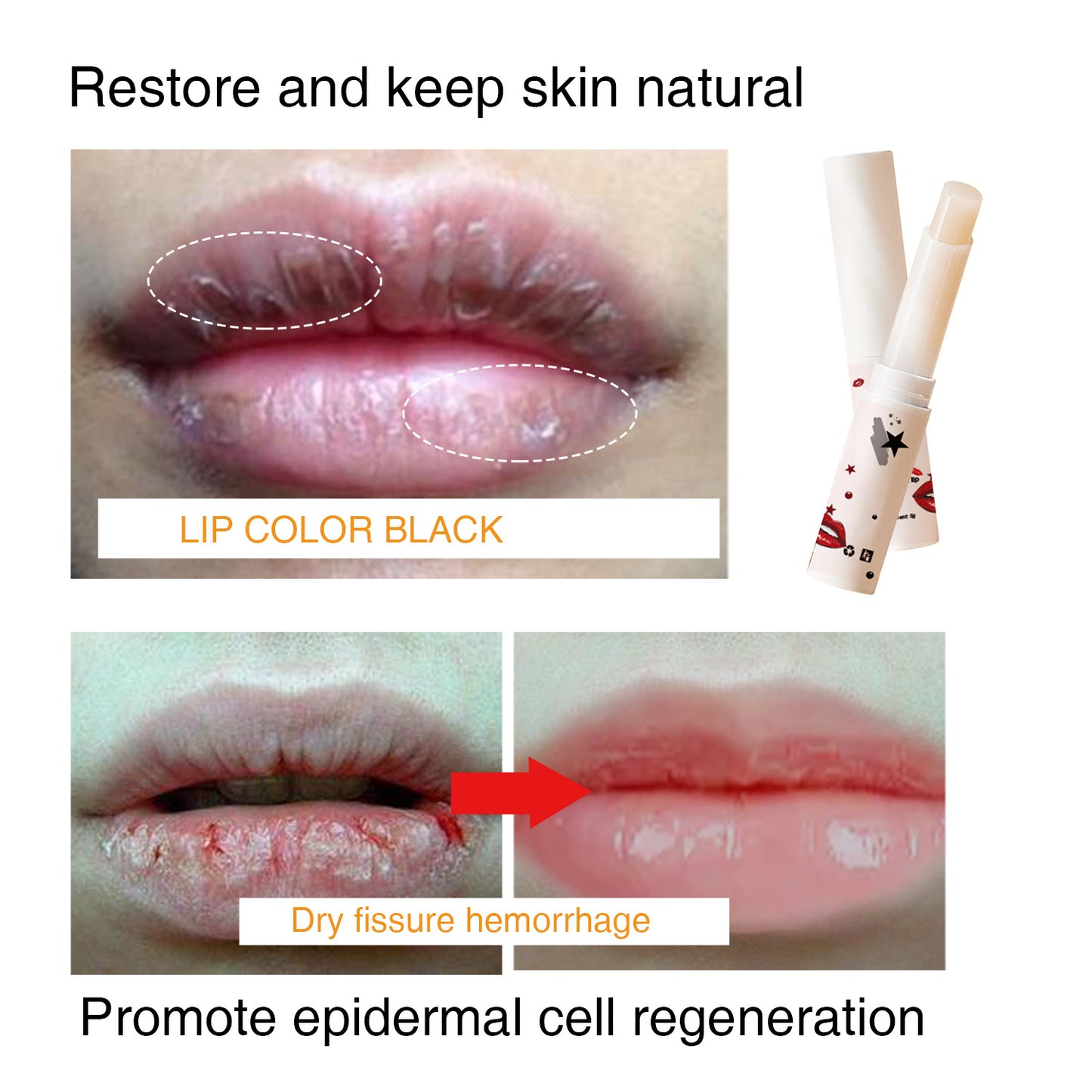 OEM Customized Lip Balm, Black Lip Removal, Lip Wrinkle Removal, Lip Care 381