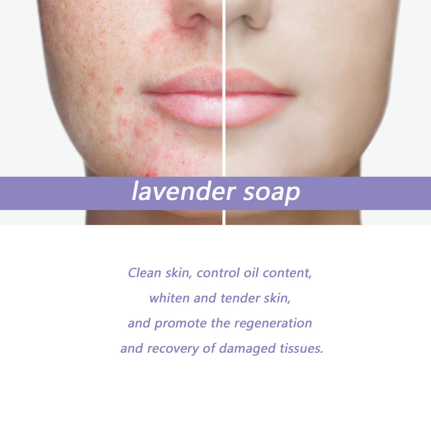 OEM & ODM Customized Lavender Soap, 100g Body Care Cleansing Soap for Acne Removal 420