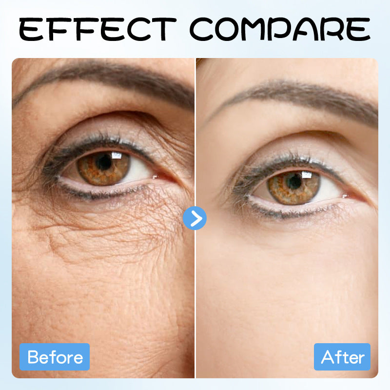 Wholesale Collagen Firming Eye Mask, Fine Skin, Rejuvenating Eye Masks OEM Factory 535