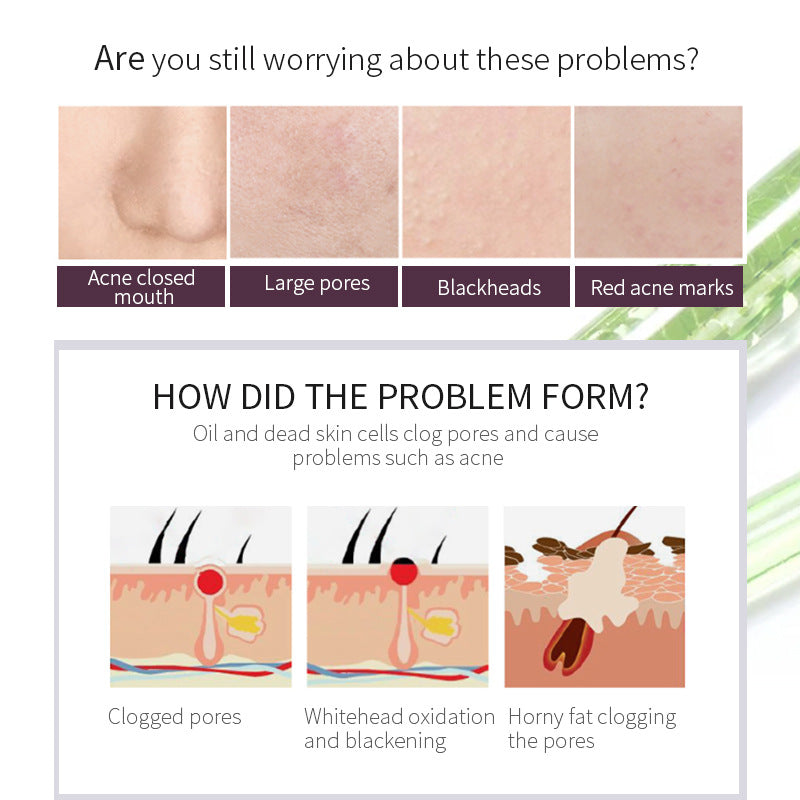 OEM Customized AHA/ BHA Essence, Cleans Pores, Softens Cuticles, Repairs Facial Acne Skin, Fruit acid Serum 150