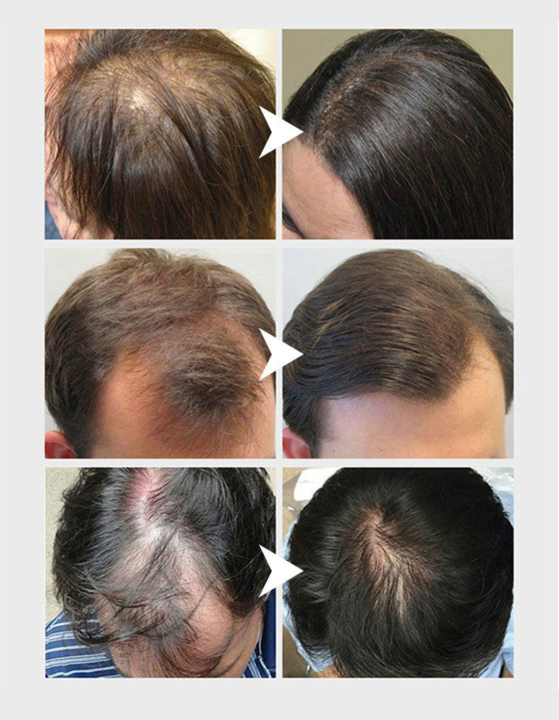 Wholesale Hair Growth Essence, Anti Hair Loss, Rice Water For Hair Growth 410