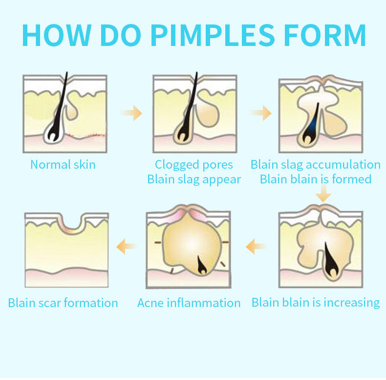 Organic Turmeric Pimple Patches Wholesale 5 Sheet Pack round Hydrocolloid Acne Patch