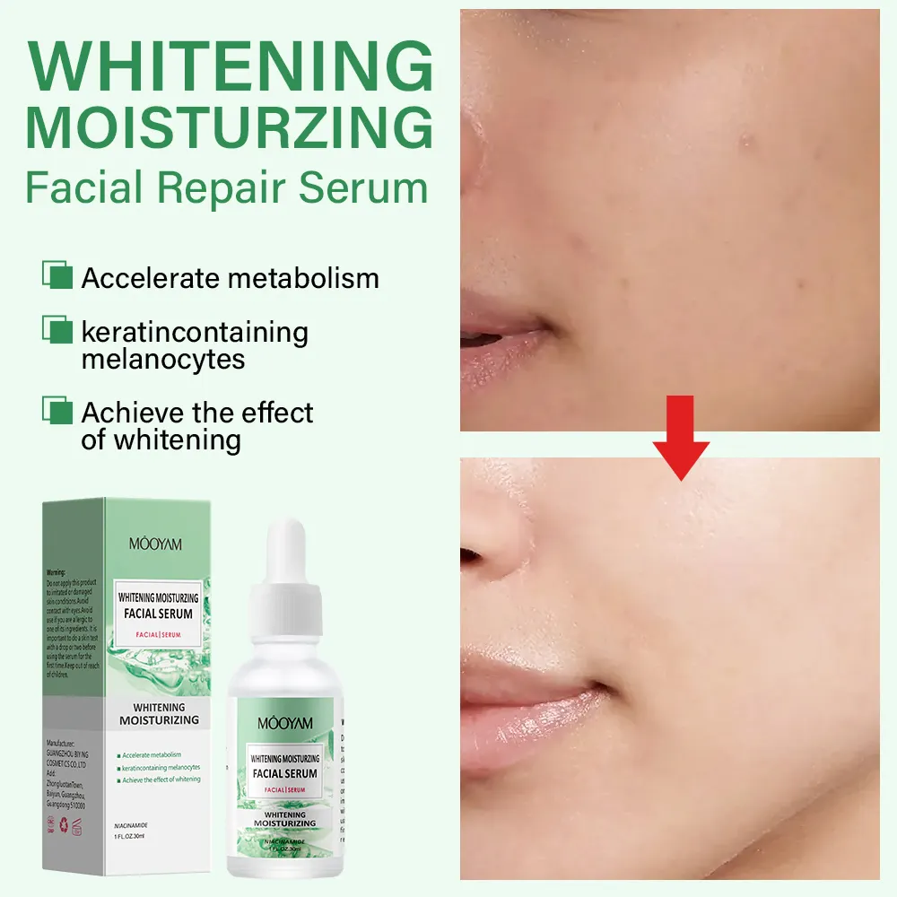 Antioxidant Skin Firming Diminishes Acne Prone Treatment Facial Whitening Serum For Black Women 588