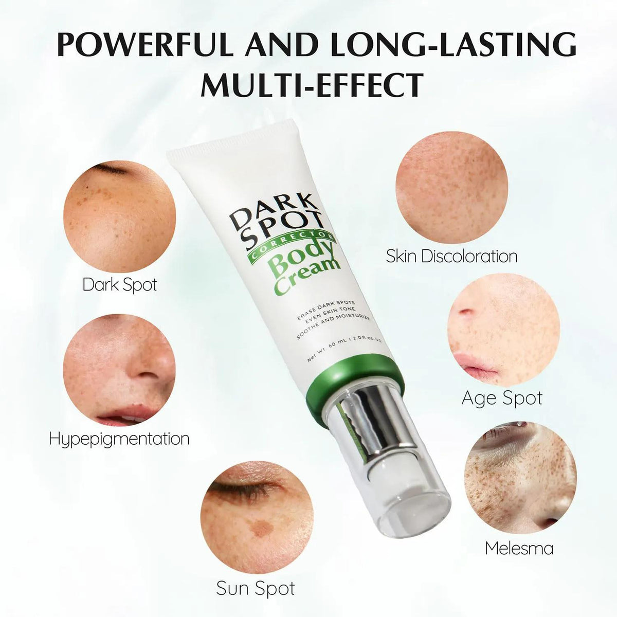 Body Spot Rash Cream Dark Spot Corrector Cream For Body, Premium Dark Spot Remover Cream Fo ...