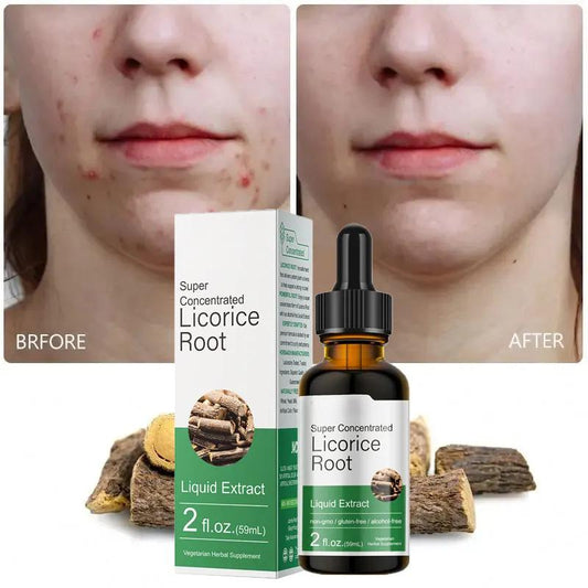 Beauty Herbal Licorice Root Serum Anti Inflammatory Facial Whitening Moisturizing Anti Acne Serum For Face 726