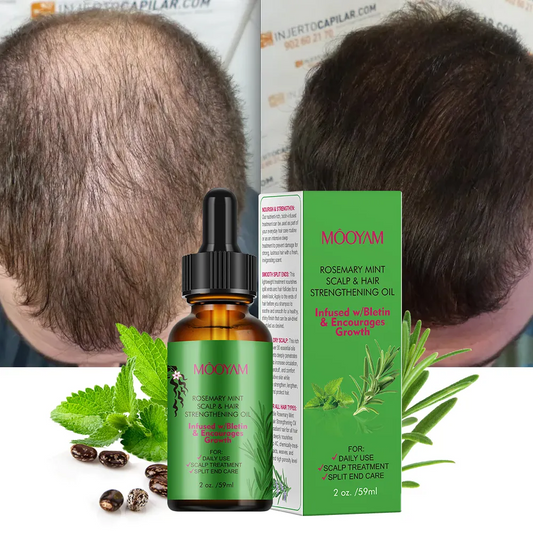 Rosemary Mint Scalp &Hair Strengthening Oil 100% Pure Nature Organic Fast Effective Hair Growth Oil 728