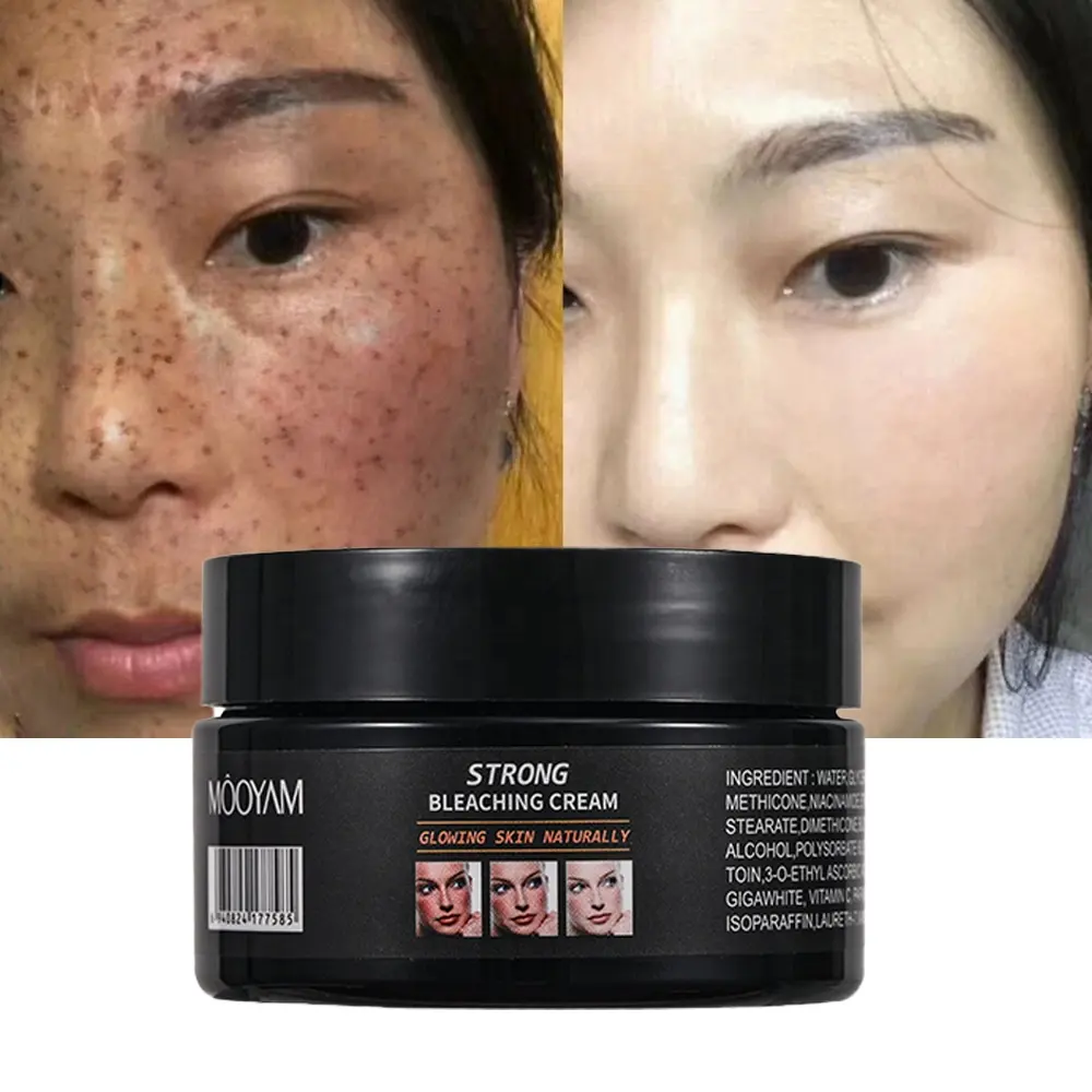 120g Skin Powerful Whitening Freckle Cream Remove Melasma Acne Spots Pigment Melanin Dark Spots Face Strong Bleaching Cream 738