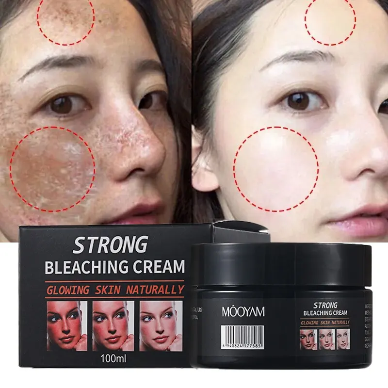 120g Skin Powerful Whitening Freckle Cream Remove Melasma Acne Spots Pigment Melanin Dark Spots Face Strong Bleaching Cream 738