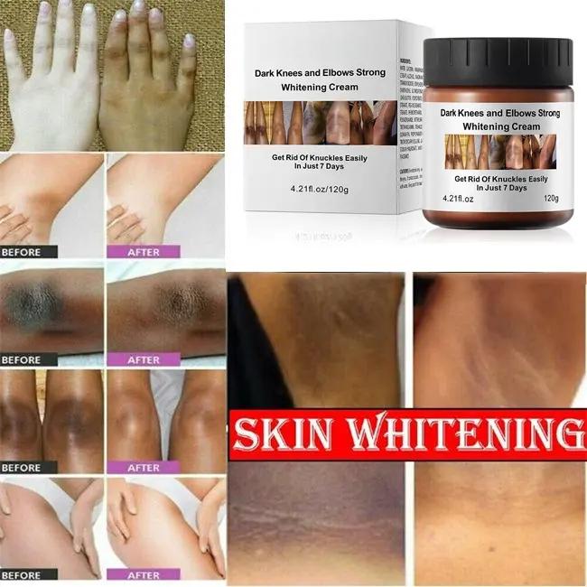 Dark Knees and Elbows Cream Strong Removal 7 Days Dark Spot Corrector Skin Care Private Label Whitening Body Cream 788