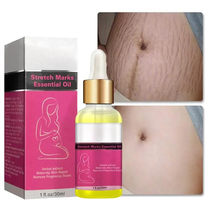 Private Label Stretch Marks Essential Oil Scar Oil 100% Natural Pure Plant Extract 7 Days Stretch Mark Removal Oil 798