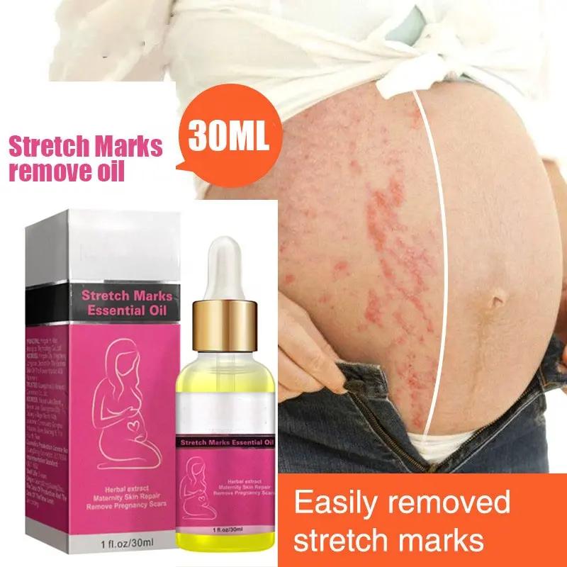 Private Label Stretch Marks Essential Oil Scar Oil 100% Natural Pure Plant Extract 7 Days Stretch Mark Removal Oil 798