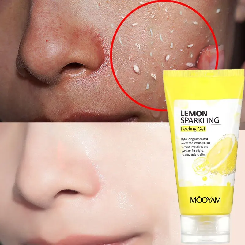 Private Label Exfoliating Lemon Sparkling Peeling Gel Dead Skin Removal Natural Deep Exfoliator Scrub Cleansing Peeling Gel 800