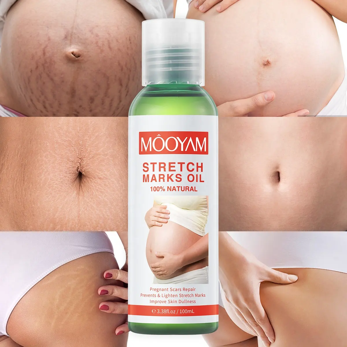 Pregnancy Scars Remove Stretch Marks Oil Treatment Maternity Repair Anti-Aging Anti-Wrinkles Firming Stretch Mark Body Oil 918