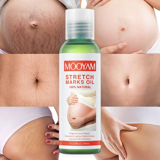 Pregnancy Scars Remove Stretch Marks Oil Treatment Maternity Repair Anti-Aging Anti-Wrinkles Firming Stretch Mark Body Oil 918