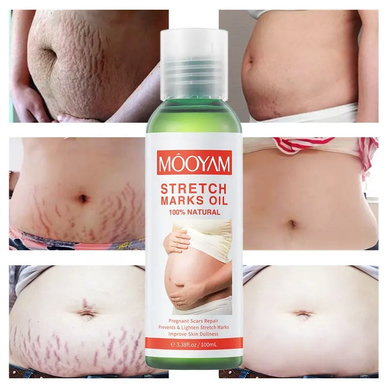 Pregnancy Scars Remove Stretch Marks Oil Treatment Maternity Repair Anti-Aging Anti-Wrinkles Firming Stretch Mark Body Oil 918