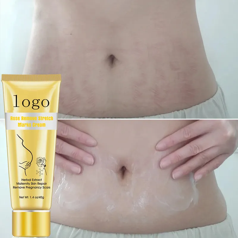 Wholesale Customize OEM stretch marks removal cream natural rose best effective repairing pregnant belly mark cream 1001